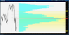 2014-02-09-TOS_CHARTS_SPXdaily3monthwithfibs.png
