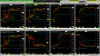 zz ES,RTY-ETF's Hammer Double Bottom.png
